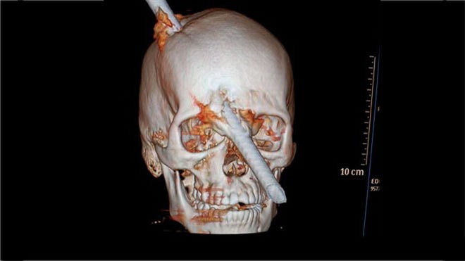tomography Miguel Couto.jpg